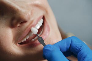 4 طرق للحفاظ على ابتسامتك بعد الفينير