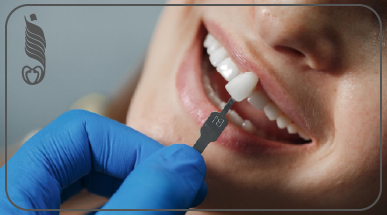 4 طرق للحفاظ على ابتسامتك بعد الفينير