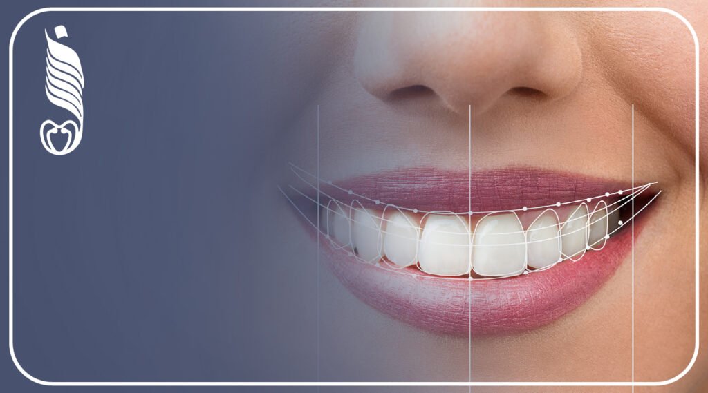 كيف الكمبيوتر بيخطّط ابتسامتك Digital Smile Design