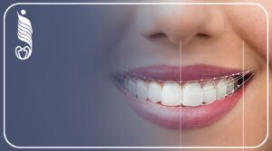 كيف الكمبيوتر بيخطّط ابتسامتك Digital Smile Design
